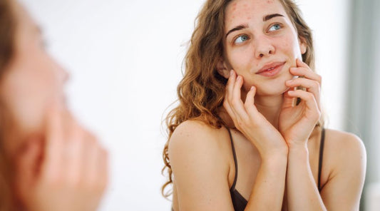 Hyperpigmentation Holding You Back? Brighten Up