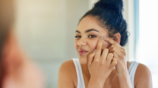 Battling Acne Doesn’t Have to Be a Battle