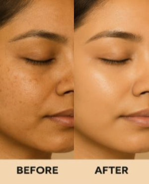 Before and after skin